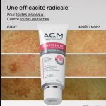 کرم ضد لک دپی وایت ای سی ام